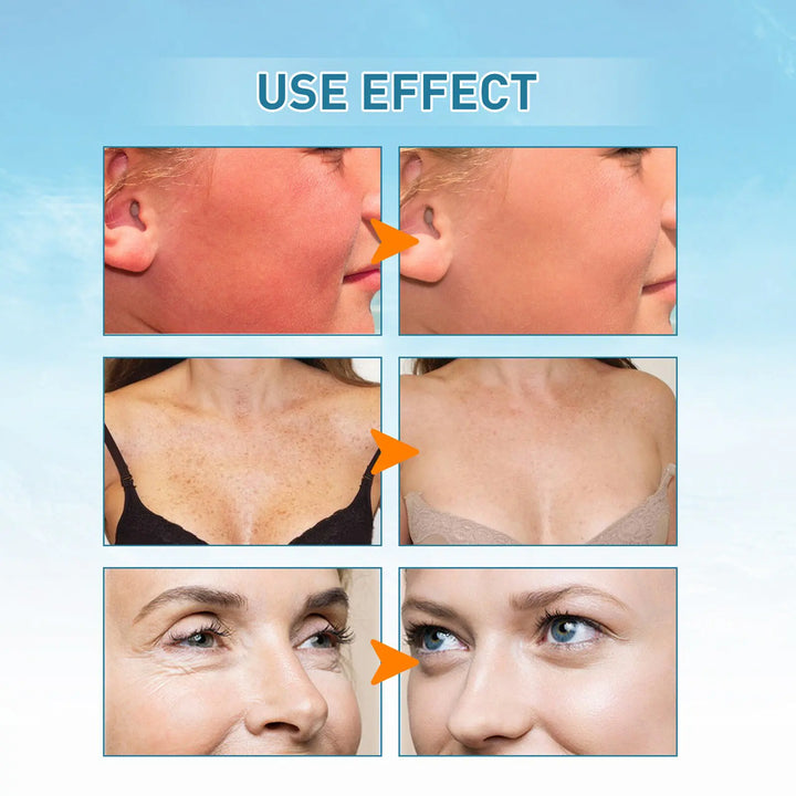 Body Hydrating Sunscreen Use Effect