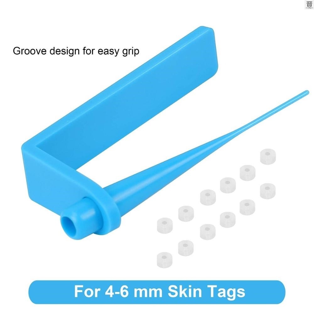 Skin tag removal band tool for 4–6 mm skin tags with cotton accessories