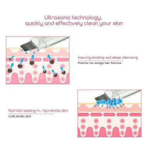 Ultrasonic facial skin scrubber device for blackhead and acne removal