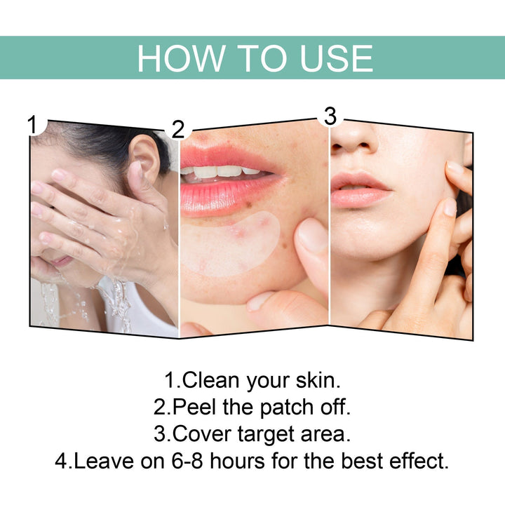 Acne Solution Patches